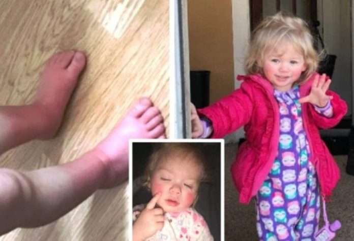 ivy-alergia-portada-770x400-2-880x600