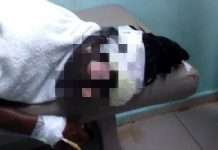 Mujer le quema la cara con aceite caliente a otra en Dajabón