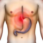 Cómo reducir un 80 % la principal complicación quirúrgica del cáncer de esófago