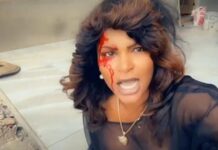 En Santo Domingo Oeste, mujer herida de bala le da golpiza a atracador